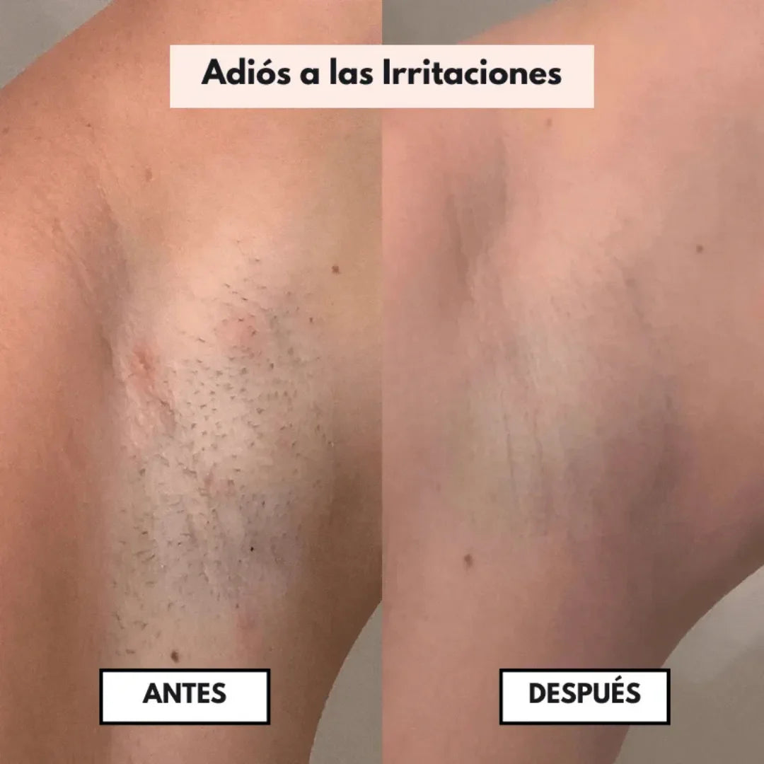 DEPILADORA ZENTORA™ 2 EN 1 IMPERMEABLE: ¡SU PIEL SUAVECITA SIN DOLOR, MAE! 🌸✨