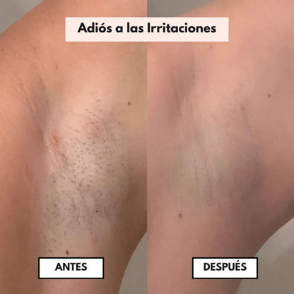 DEPILADORA ZENTORA™ 2 EN 1 IMPERMEABLE: ¡SU PIEL SUAVECITA SIN DOLOR, MAE! 🌸✨